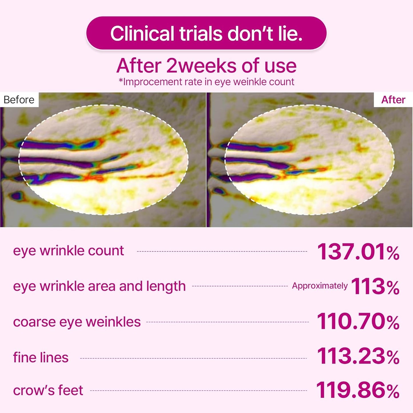 Calcium Volume Eye Patch™