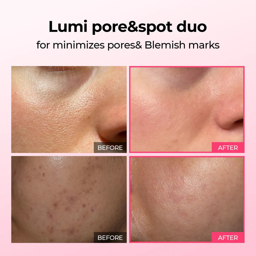Pore & Spot Duo™