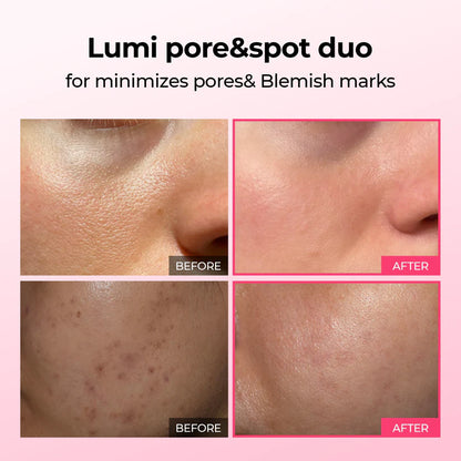 Pore & Spot Duo™