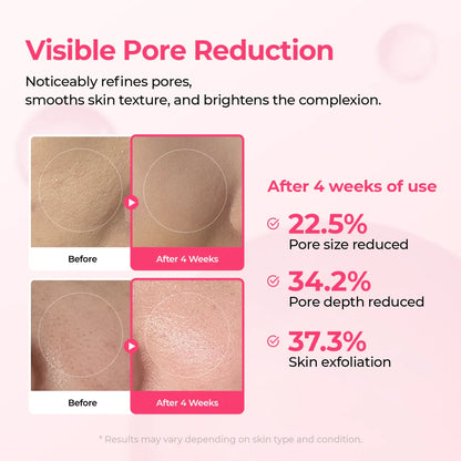 Pore & Spot Duo™