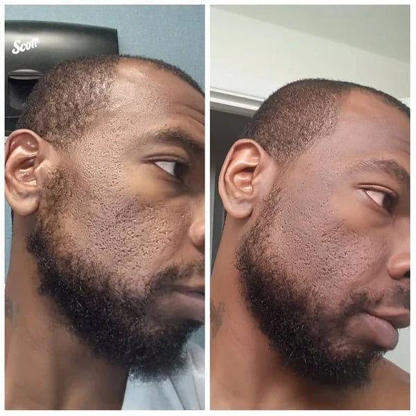 Peau réelle, vrais résultats…